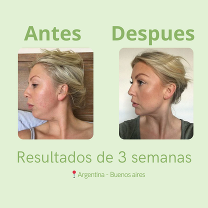 Fluvia: Cápsulas Desinflamantes Corporales